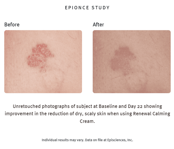 Renewal Calming Cream